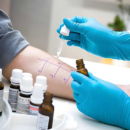 Allergy Testing