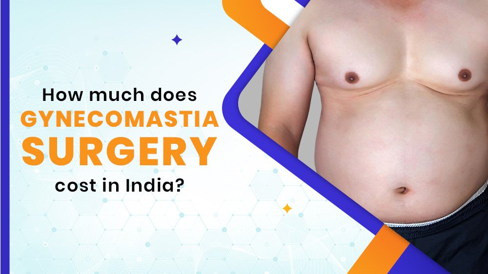 Gynecomastia Surgery Cost in India